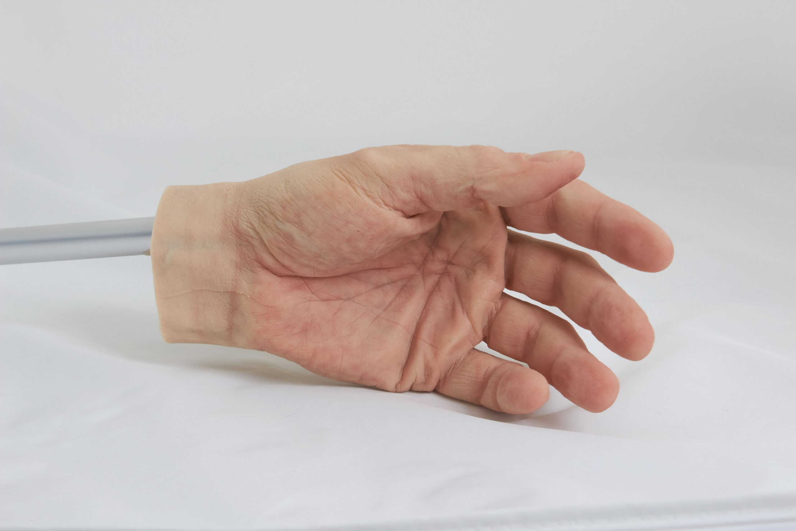 Mitschke Sanitätshaus_Silikonhand Silikon Prothese