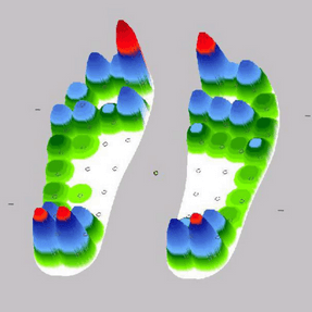 Abbildung Füße in der 3D-Fußanalyse